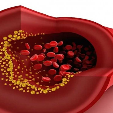 Total cholesterol em Barry / Wales